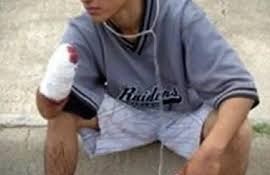 Río Negro: Comerciante se defendió de un ladrón y le cortó la mano con un&nbsp;machete